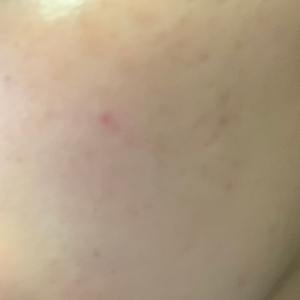 キールズ　クリーム-UFC